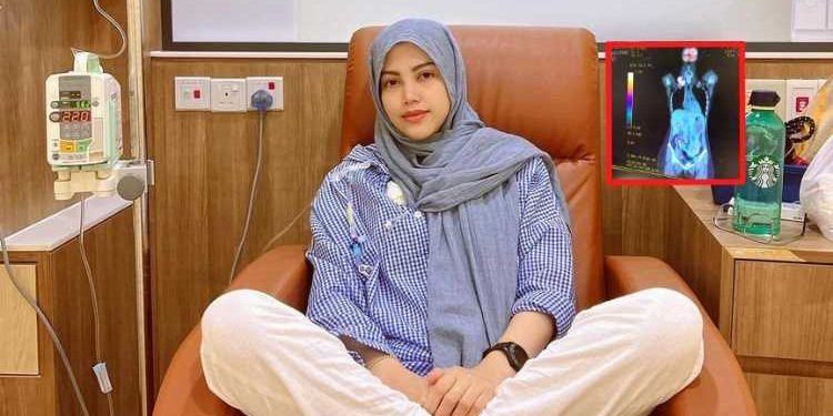 “Alhamdulillah, Ya Allah!” – 11 Tahun Derita, Kanser Limfoma Elyana Berakhir