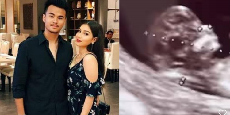 “Dah Mengandung Eh?” – Muat Naik Foto Imbasan Ultrasound, Elisya Sandha Kini Hamil?