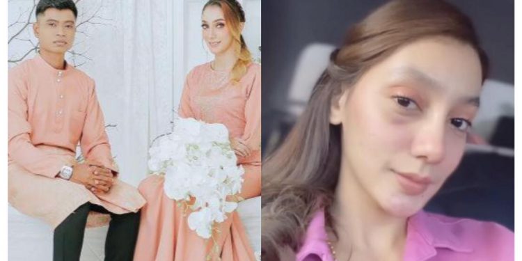 “Ingat Saya Tak Ada Akal Ke?” – Usop Nafi Jadi Penyebab Mata Tunangnya Lebam