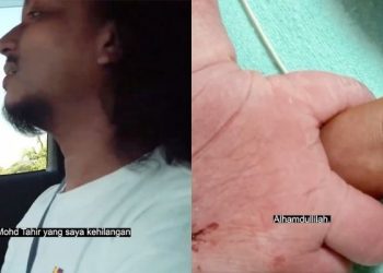 “Saya Amat Perlukan Anak Ini” – Faizal Tahir Dikurniakan Anak Ketujuh Sindrom Down