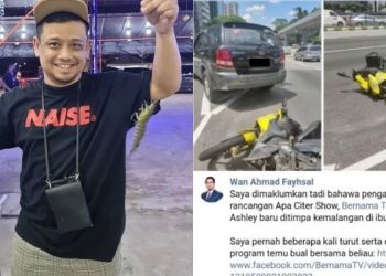 Gara-Gara Pemandu Cuai Tengok Waze, Hilmy Ashley Hampir Maut Dilanggar Kereta