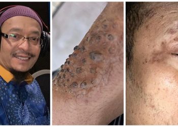 “Tiba-tiba Darah Terkeluar… ” – Ustaz Kazim Dedah Keadaan Sebenar Dirinya Tanpa Solekan