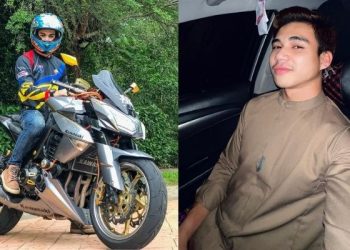 7 Kali Kemalangan, Bapa Suruh Atiq Azman Jual Motor Besar, Bimbang Wajah Berparut