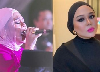 Aktif Sejak Kanak-Kanak, Erna Elliyana Masih Rindukan Bidang Nyanyian Dan Lakonan