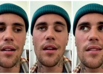 [VIDEO] “Wajah Saya Lumpuh” – Hidapi Ramsay Hunt Syndrome, Konsert Bieber Batal?