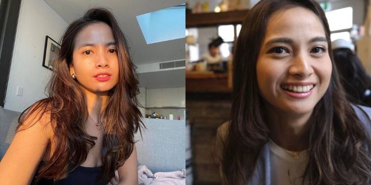 Acha Septriasa Dedah Mula Sedar Hanya Miliki Satu Ginjal Pada Usia 18 Tahun