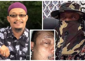Disaran Pakai Topi, Ustaz Kazim Bakal Berangkat Ke Arab Jalani Rawatan Penyakit Kulit