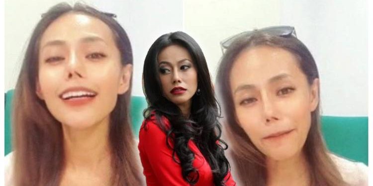 [V] Empat Kali Buat Pembedahan Kosmetik, Hidung Korea Lana Nodin Berharga RM166,000