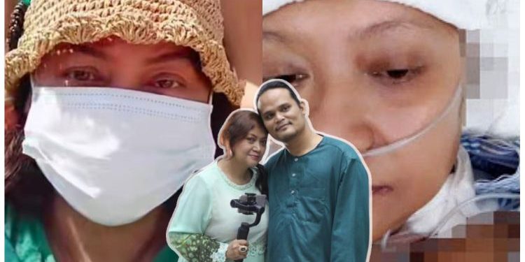 [V] Terkena Kencing Tikus, Kaki Shahriza Mahmud Hampir Lumpuh – “Tak Terdaya Nak Kerja”