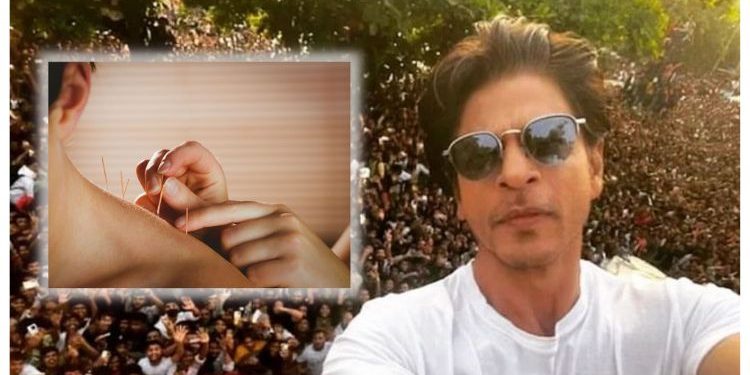 Zakar Dicucuk Jarum, Shah Rukh Khan Menggigil Sepanjang Jalani Rawatan Akupuntur