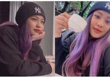 Rawat Luka Di Itali, Rambut Janna Nick Bertukar Warna Ungu – “Hanya Saya Sendirian…”