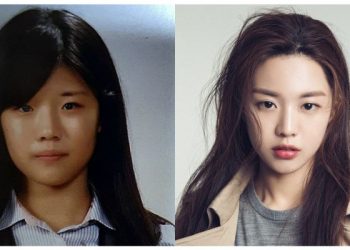 Wajah Jauh Berbeza Dulu Dan Sekarang, Ramai Syak Go Youn-jung Buat Pembedahan Plastik