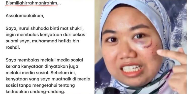 Shuhada Tak Gentar, Balas Surat Terbuka Hafidz Roshdi – “Saya Akan Ambil Tindakan…”