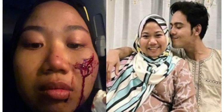 “Terima Kasih Tinggalkan Cacat Kekal Di Muka Aku, Semoga Allah Balas!” – Bekas Isteri Hafidz Roshdi