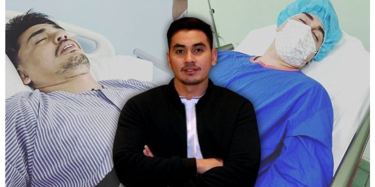 “Suka Sangat Makan Pedas, Last-last Kena Apendiks!” – Sabhi Saddi Masuk Wad