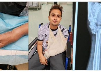 Haziq Hussni Patah Pergelangan Tangan Ketika Bermain Bola Sepak