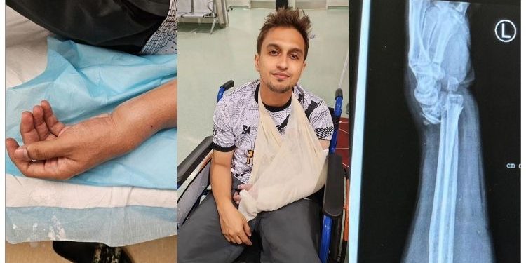 Haziq Hussni Patah Pergelangan Tangan Ketika Bermain Bola Sepak
