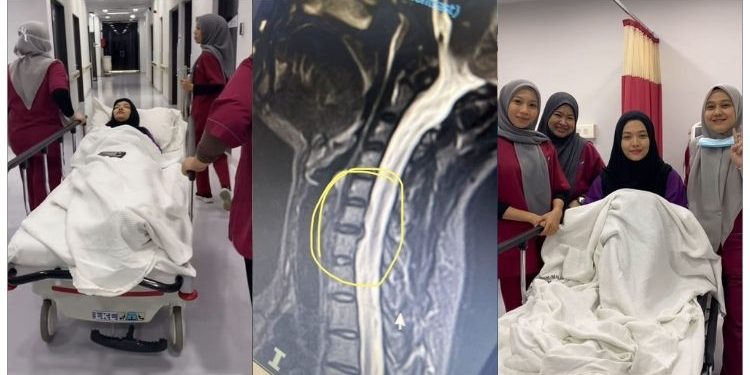 3 Hari Tak Dapat Gerakkan Leher, Syatilla Melvin Disahkan Alami ‘Slip Disc’