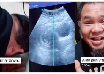 Taiyuddin Dan Isteri Timang Bayi Sulung Selepas 9 Tahun Menanti