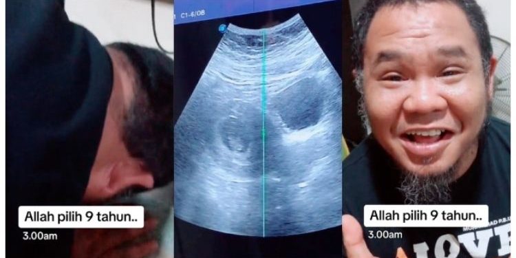 Taiyuddin Dan Isteri Timang Bayi Sulung Selepas 9 Tahun Menanti