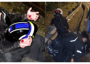 Ismail Izzani Terlibat Kemalangan Motosikal, Tiada Kecedaraan Serius Dialami