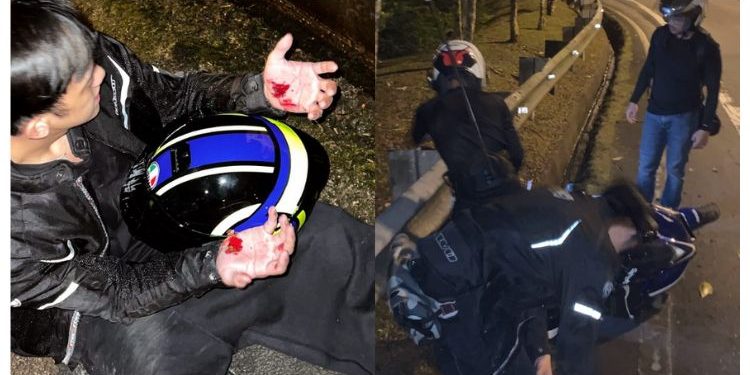 Ismail Izzani Terlibat Kemalangan Motosikal, Tiada Kecedaraan Serius Dialami