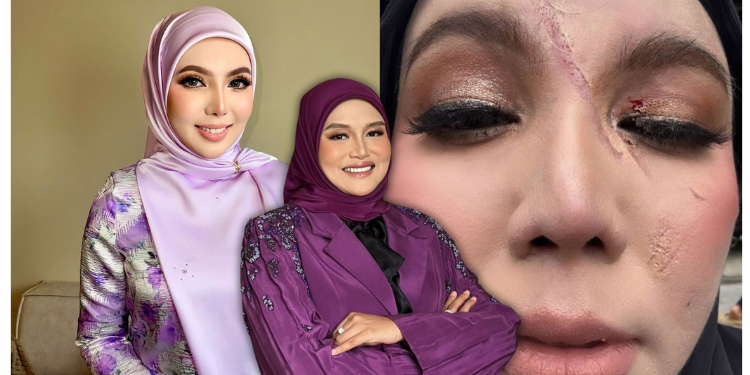 Dituduh Menipu Luka Dicakar, Dr Raihana Tampil Pertahan Cik Epal