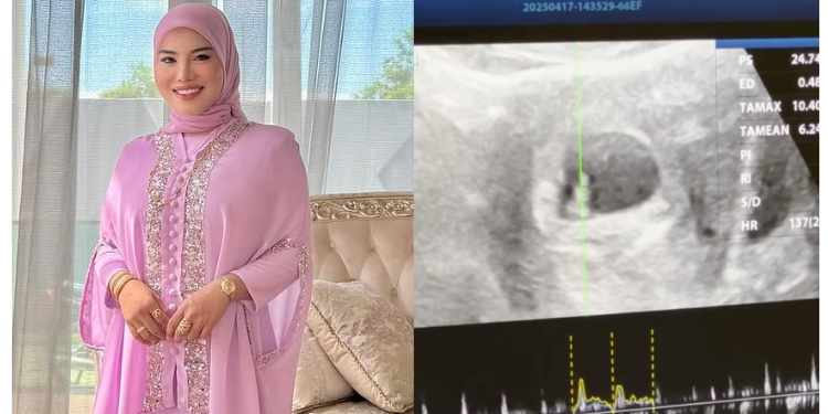 [V] “Maaf Tak Jaga Kamu Dengan Baik” – Watie Reda Keguguran, Kongsi Mimpi Petanda Awal