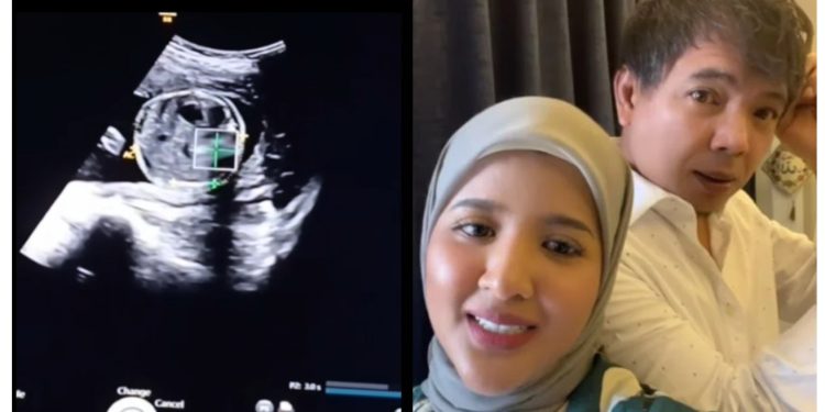 Azlan Komeng’s Wife Pregnant With First Child, Chooses To Stay For Their Heir