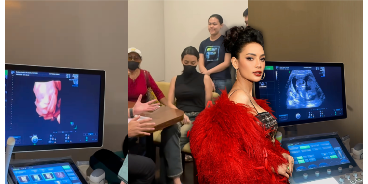 [V] Pregnant Out Of Wedlock, Erika Carlina Seeks Public Support