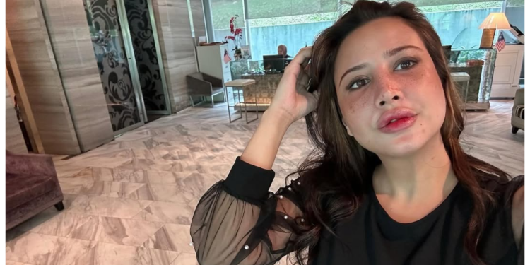 “Rasa Macam Bukan Diri Sendiri” – Fatiya Latiff Sedih Wajah Berubah Lepas Buat Fillers