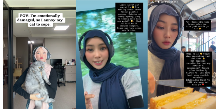 “Eye & Nose Surgery?” – Kim Seri’s Latest Appearance Sparks Speculation