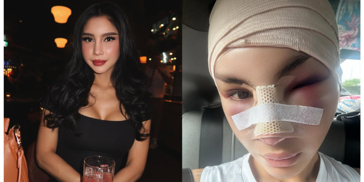 [V] Ditegur Netizen Lepas Buat Hidung, Nur Sajat Jelaskan Sebab Sebenar