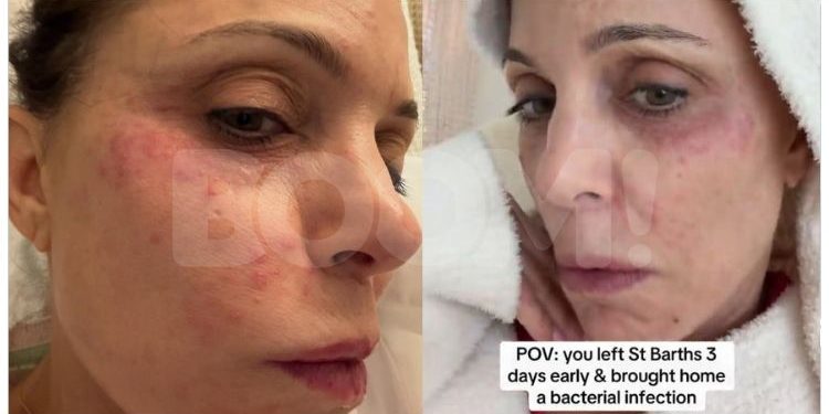 Percutian Mewah Bethenny Frankel Di St. Barths Bertukar Mimpi Ngeri